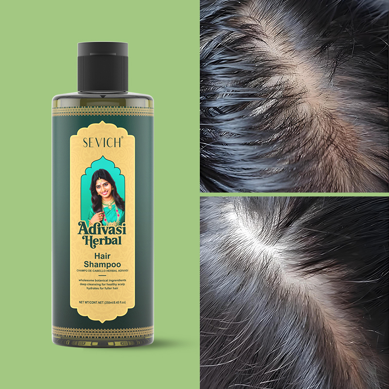 헤어 성장 오일 세트 로즈마리 헤어 성장 오일 천연 허 - Hair Care India 리뷰 및 가격
